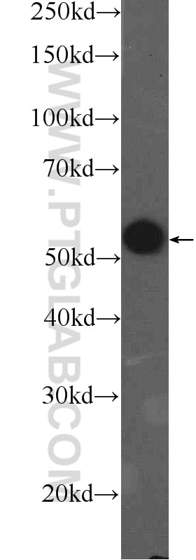 Western Blot (WB) analysis of COLO 320 cells using PKM Polyclonal antibody (25659-1-AP)