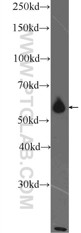 Western Blot (WB) analysis of SMMC-7721 cells using PKM Polyclonal antibody (25659-1-AP)