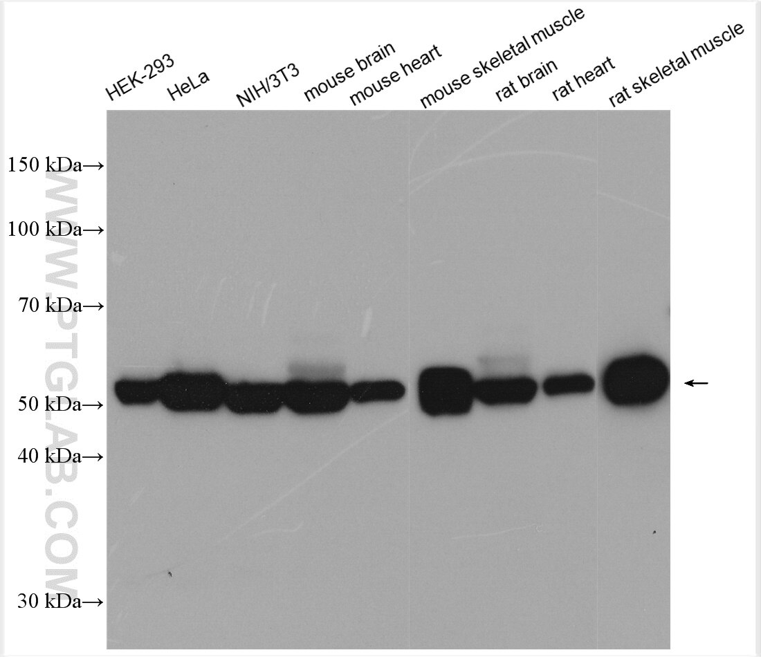 Western Blot (WB) analysis of various lysates using PKM Polyclonal antibody (25659-1-AP)