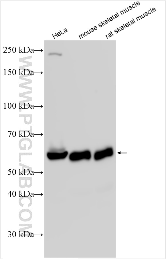 Western Blot (WB) analysis of various lysates using PKM Polyclonal antibody (25659-1-AP)