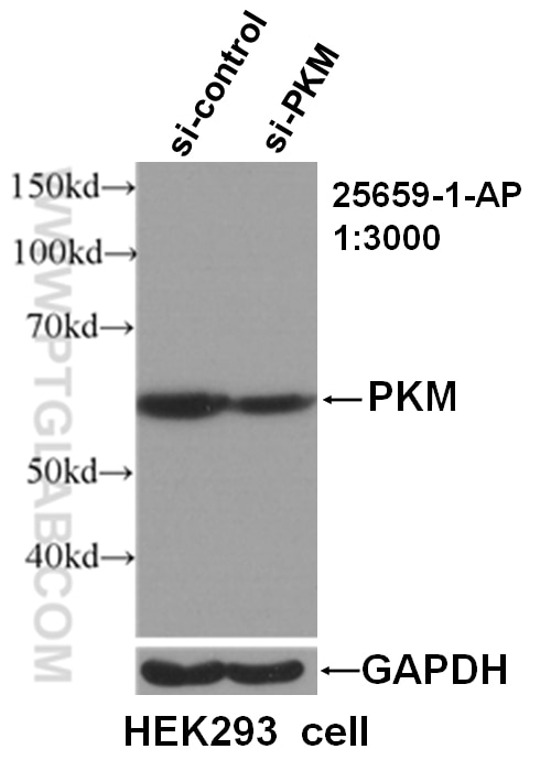 Western Blot (WB) analysis of KEK293 cells using PKM Polyclonal antibody (25659-1-AP)