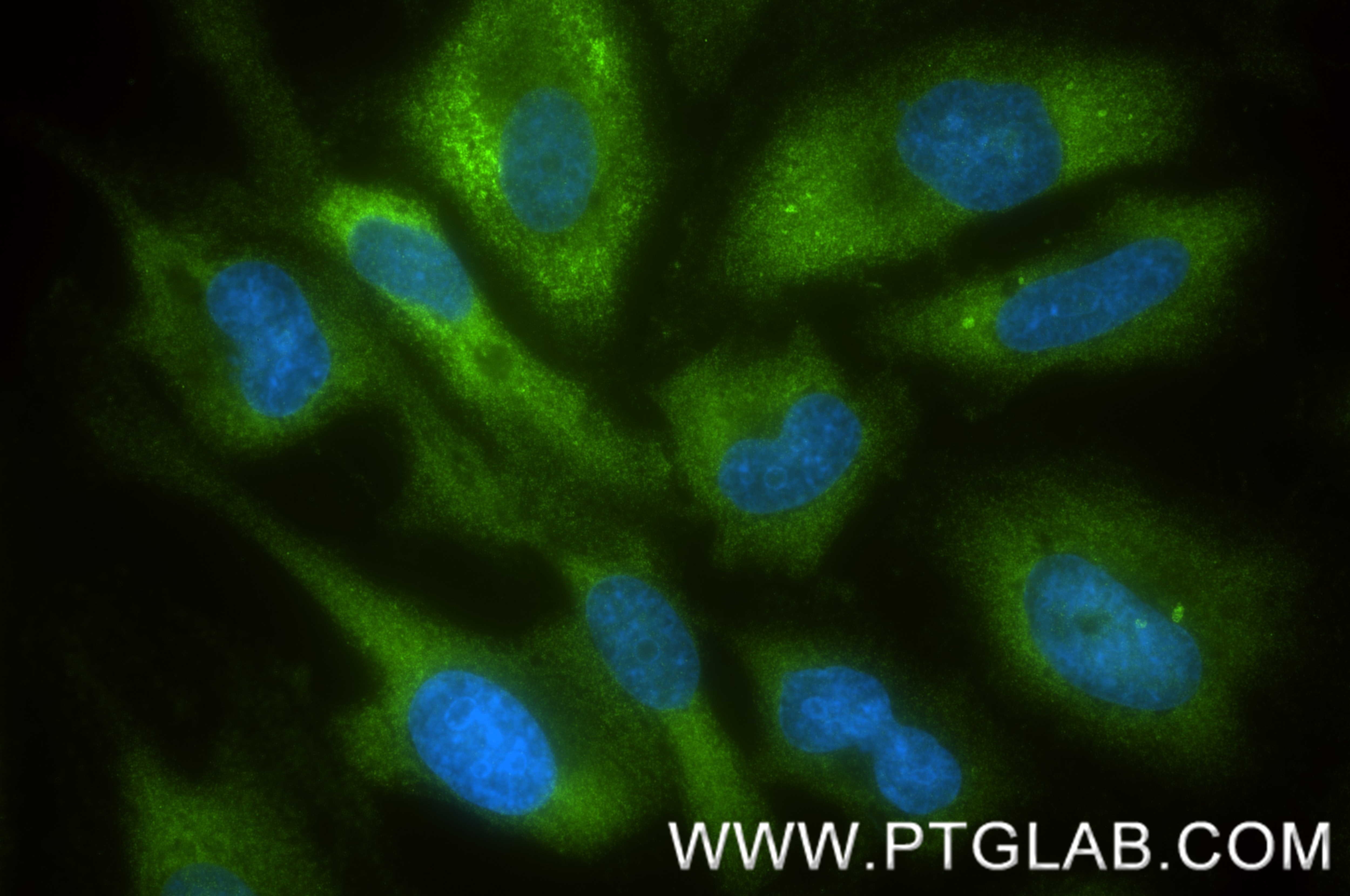 Immunofluorescence (IF) / fluorescent staining of HeLa cells using PKM Recombinant monoclonal antibody (84451-3-RR)