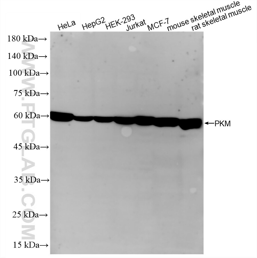 Western Blot (WB) analysis of various lysates using PKM Recombinant monoclonal antibody (84451-3-RR)
