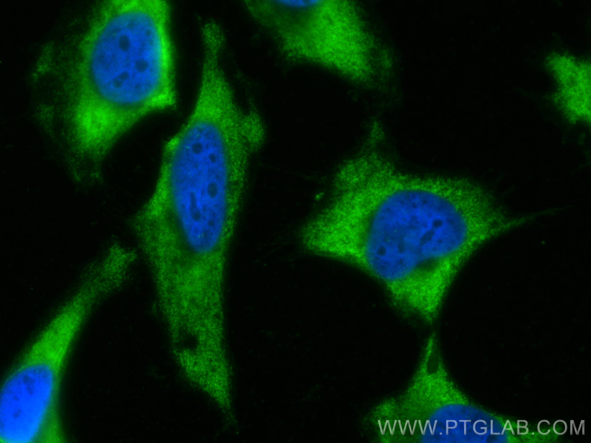 Immunofluorescence (IF) / fluorescent staining of HeLa cells using CoraLite® Plus 488-conjugated PKM Polyclonal antib (CL488-10078)