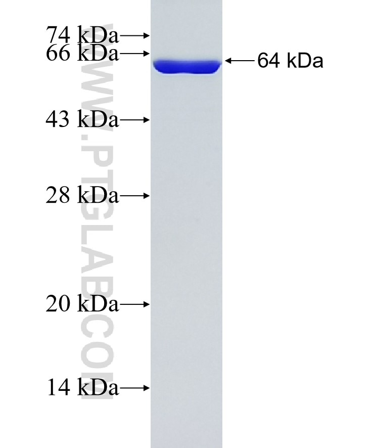 PKM fusion protein Ag20270 SDS-PAGE