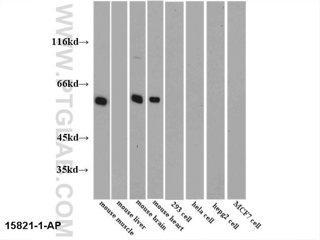Western Blot (WB) analysis of multi-cells/tissue using PKM1-specific Polyclonal antibody (15821-1-AP)
