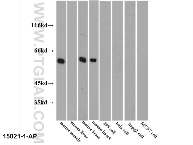 WB analysis of multi-cells/tissue using 15821-1-AP