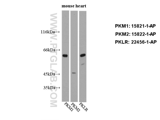 Western Blot (WB) analysis of mouse heart tissue using PKM1-specific Polyclonal antibody (15821-1-AP)