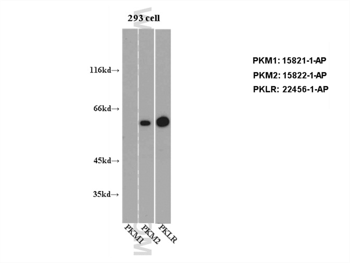 Western Blot (WB) analysis of 293 cell using PKM1-specific Polyclonal antibody (15821-1-AP)