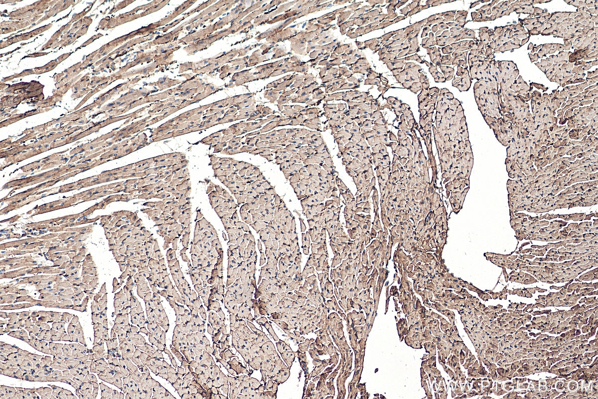 Immunohistochemistry (IHC) staining of mouse heart tissue using PKM1-specific Polyclonal antibody (15821-1-AP)