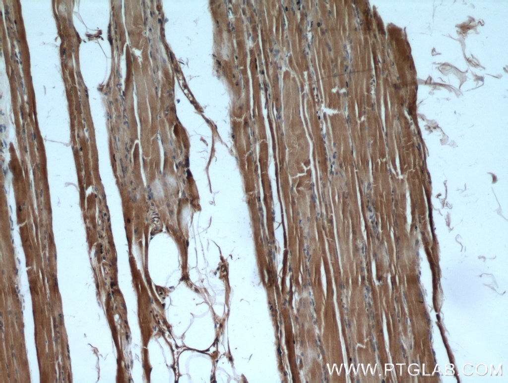 Immunohistochemistry (IHC) staining of human skeletal muscle tissue using PKM1-specific Polyclonal antibody (15821-1-AP)