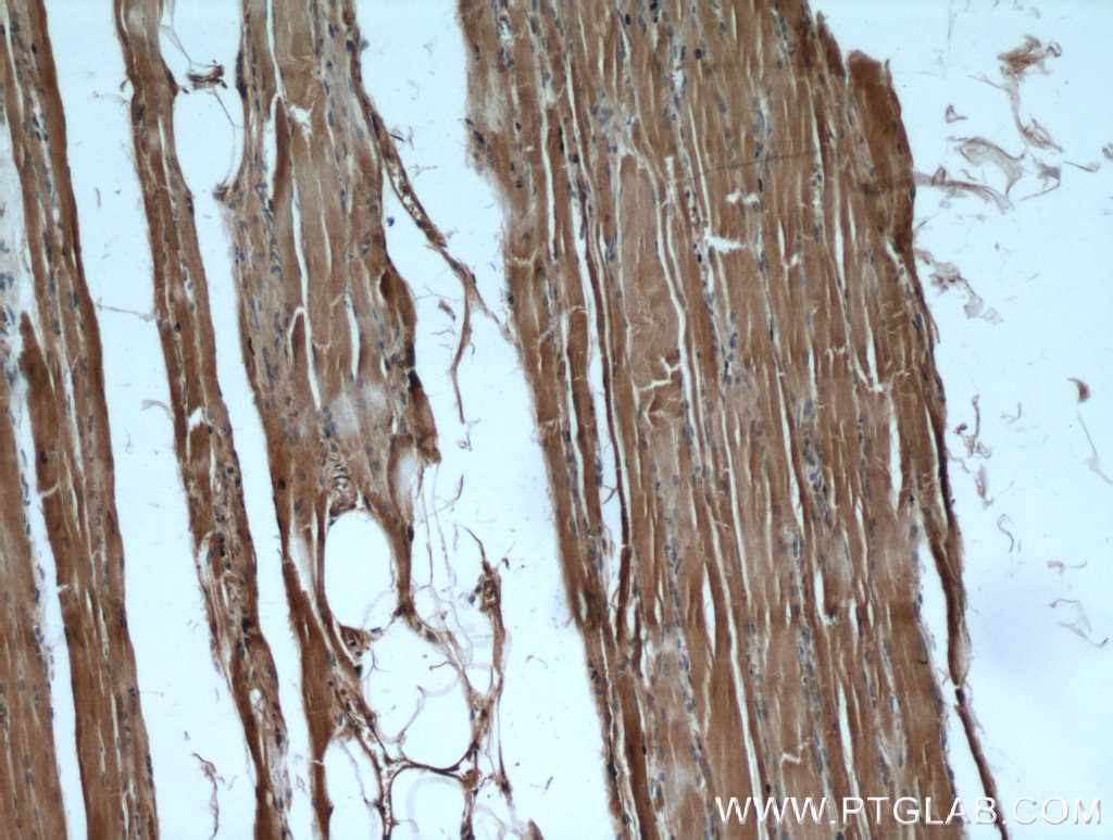 IHC staining of human skeletal muscle using 15821-1-AP