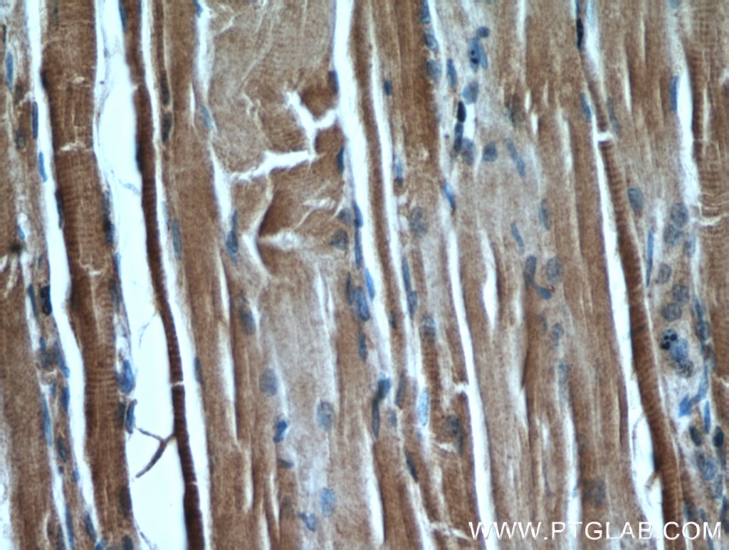 Immunohistochemistry (IHC) staining of human skeletal muscle tissue using PKM1-specific Polyclonal antibody (15821-1-AP)