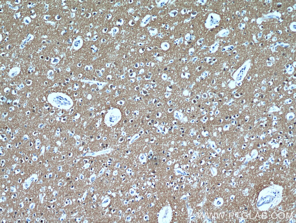 IHC staining of human brain using 15821-1-AP