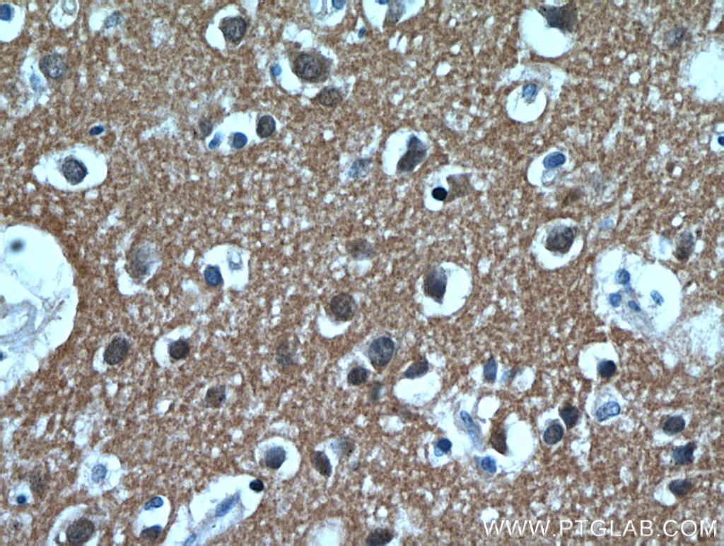 Immunohistochemistry (IHC) staining of human brain tissue using PKM1-specific Polyclonal antibody (15821-1-AP)