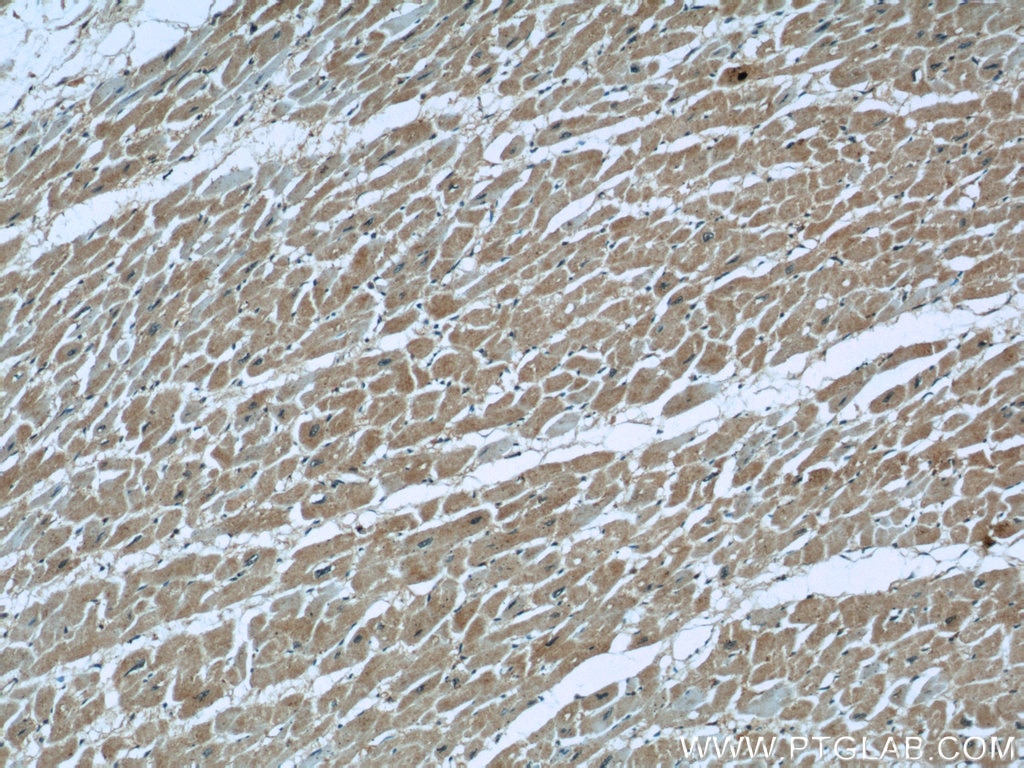 Immunohistochemistry (IHC) staining of human heart tissue using PKM1-specific Polyclonal antibody (15821-1-AP)