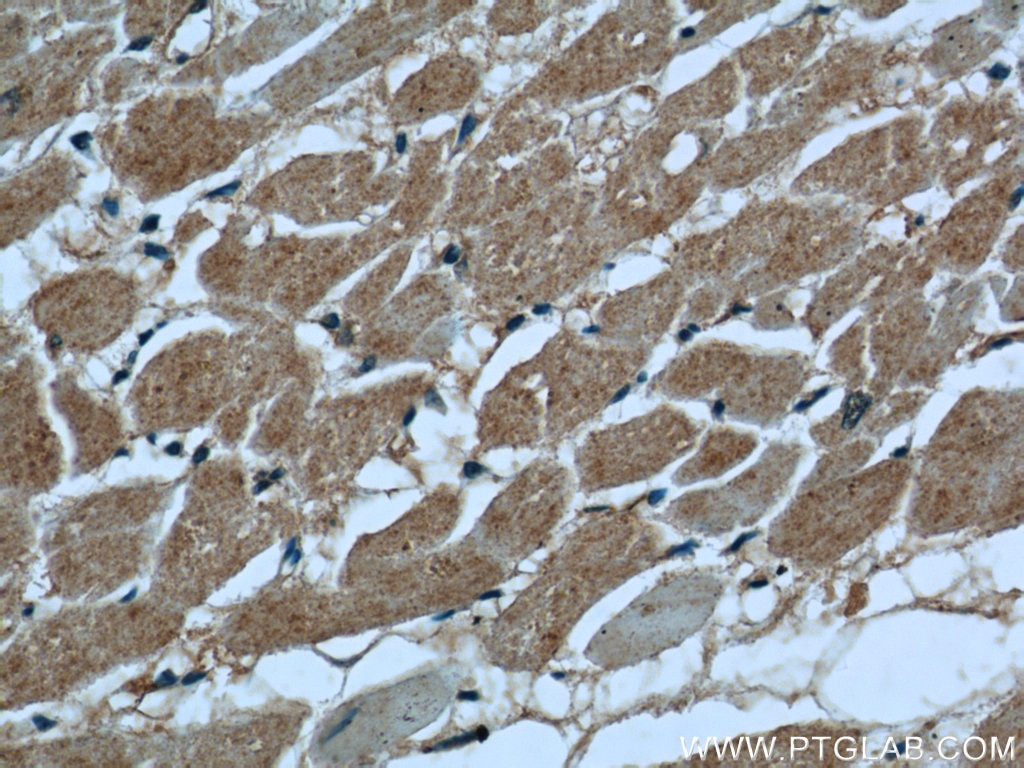 Immunohistochemistry (IHC) staining of human heart tissue using PKM1-specific Polyclonal antibody (15821-1-AP)