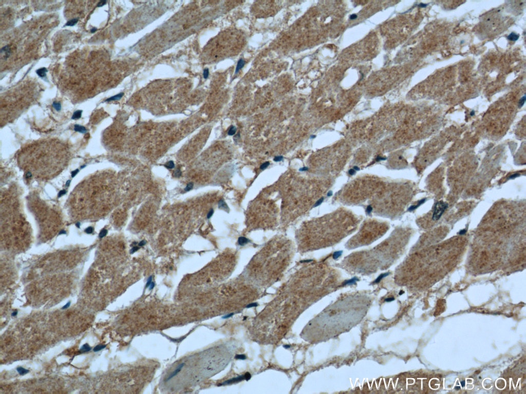 IHC staining of human heart using 15821-1-AP