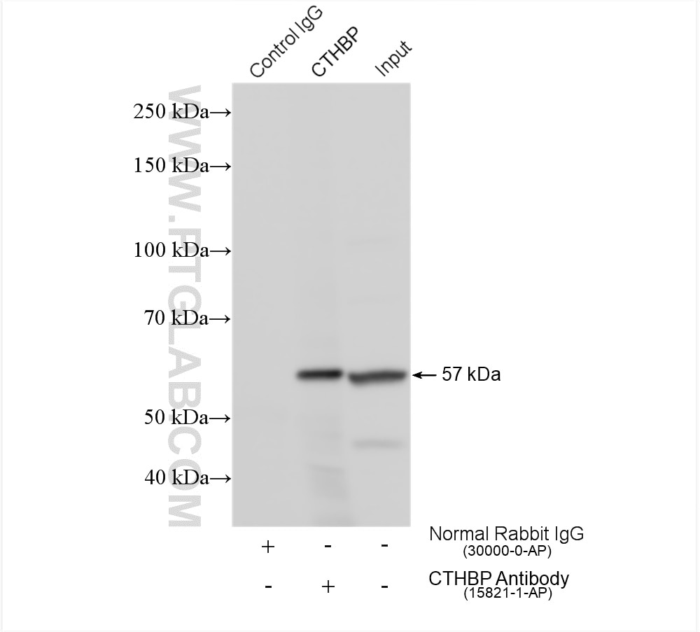 IP experiment of mouse brain using 15821-1-AP