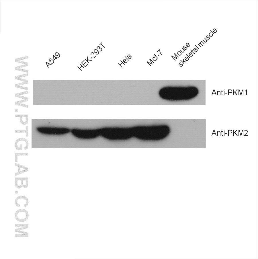 Western Blot (WB) analysis of various lysates using PKM1-specific Polyclonal antibody (15821-1-AP)