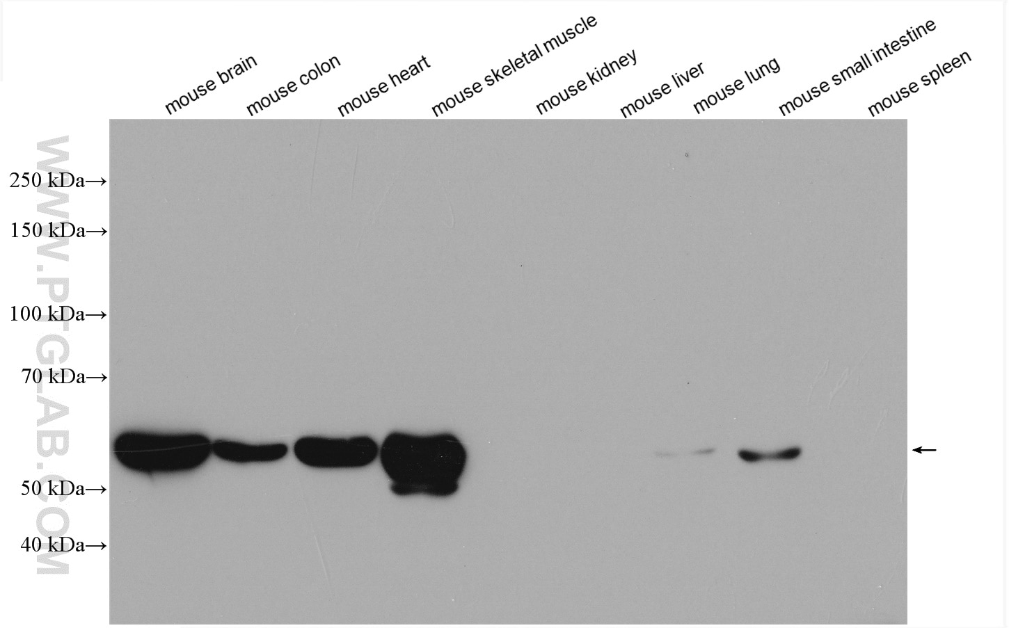 Western Blot (WB) analysis of various lysates using PKM1-specific Polyclonal antibody (15821-1-AP)