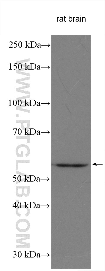 Western Blot (WB) analysis of various lysates using PKM1-specific Polyclonal antibody (15821-1-AP)