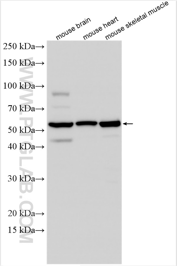 Western Blot (WB) analysis of various lysates using PKM1-specific Polyclonal antibody (15821-1-AP)