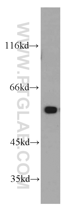 Western Blot (WB) analysis of mouse skeletal muscle tissue using PKM1-specific Polyclonal antibody (15821-1-AP)