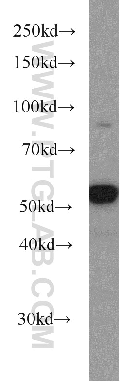 Western Blot (WB) analysis of mouse brain tissue using PKM1-specific Polyclonal antibody (15821-1-AP)