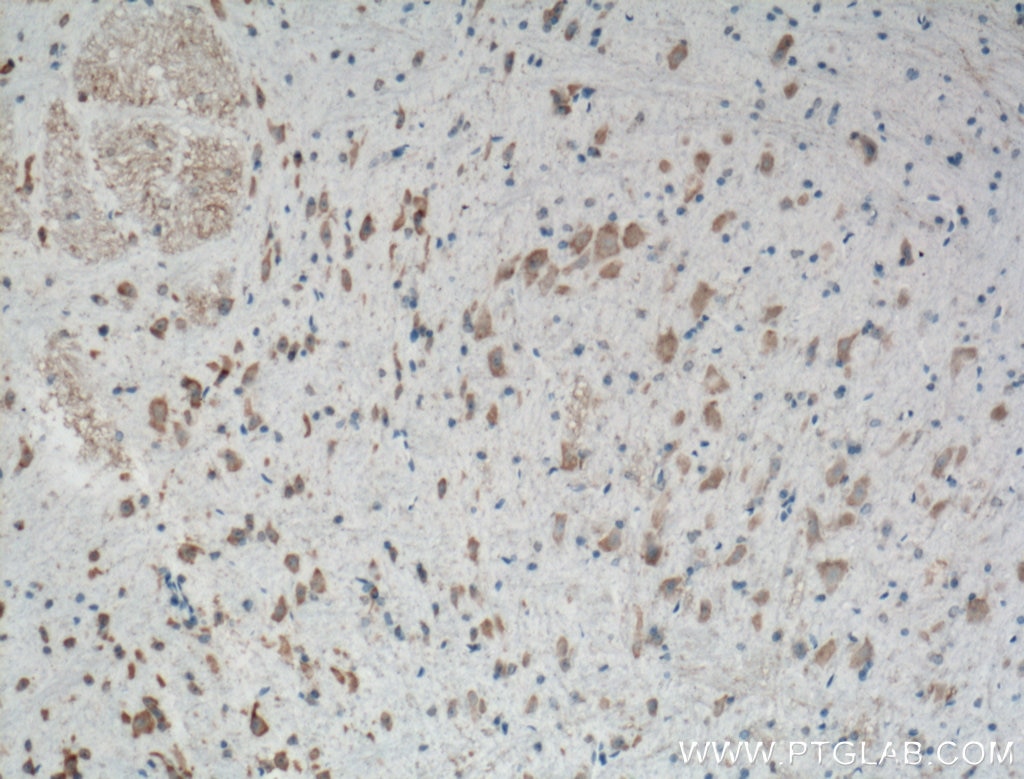 Immunohistochemistry (IHC) staining of mouse brain tissue using Biotin-conjugated PKM1-specific Polyclonal antibod (Biotin-15821)