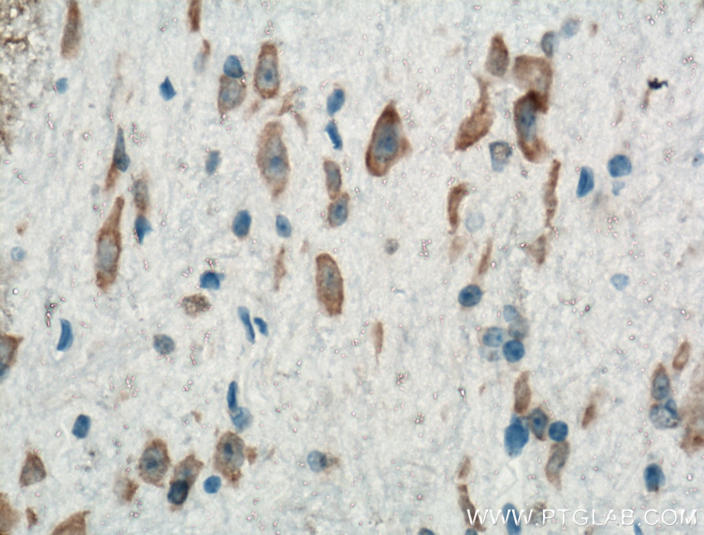 Immunohistochemistry (IHC) staining of mouse brain tissue using Biotin-conjugated PKM1-specific Polyclonal antibod (Biotin-15821)