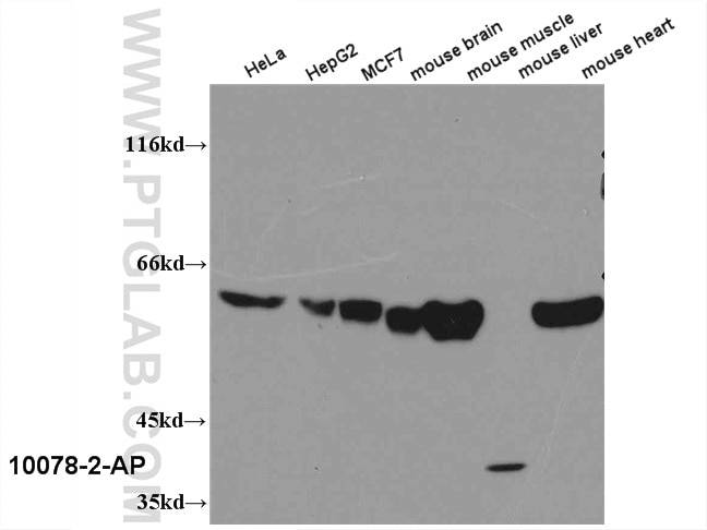 Western Blot (WB) analysis of multi-cells/tissue using PKM Polyclonal antibody (10078-2-AP)