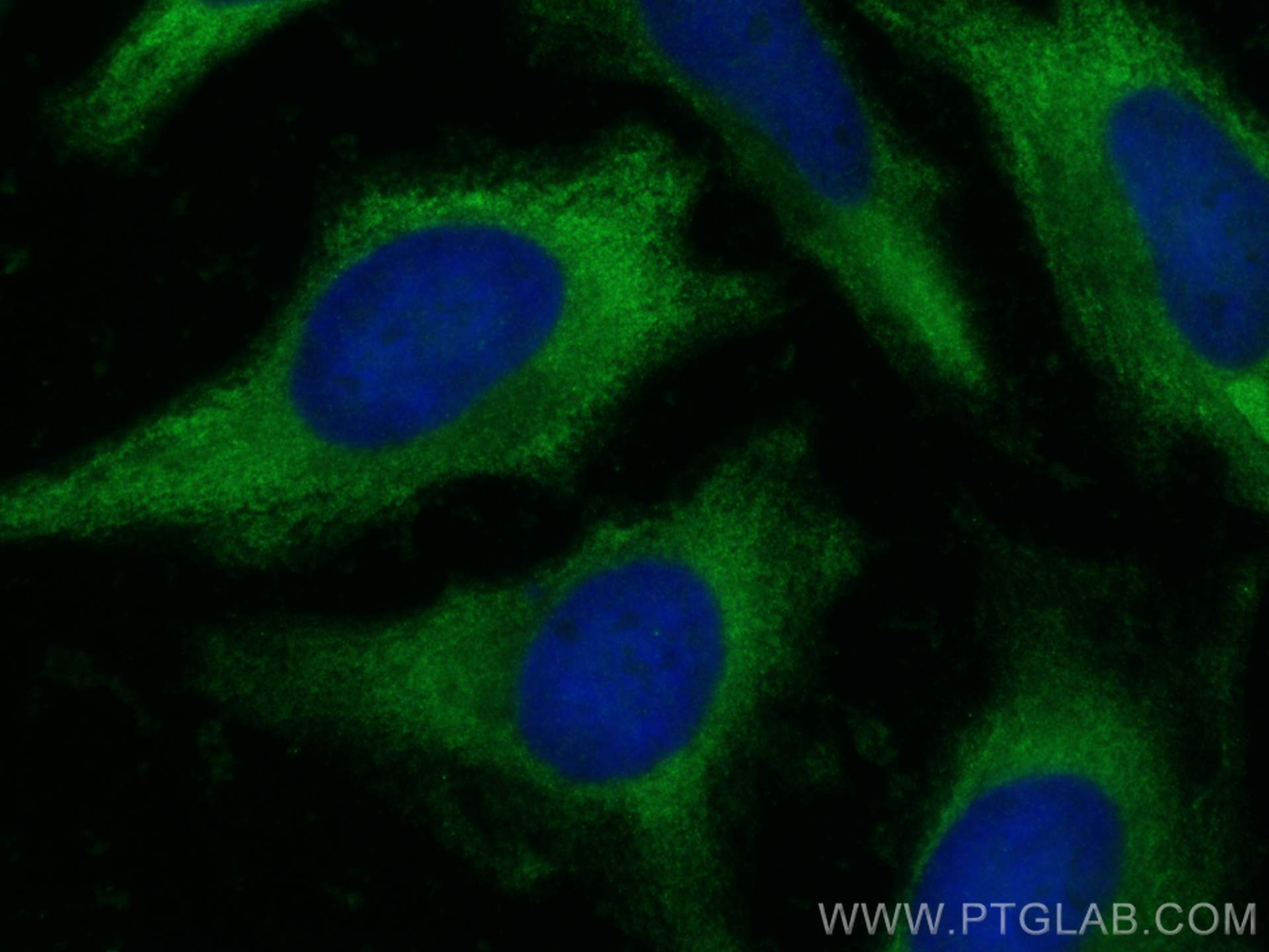 Immunofluorescence (IF) / fluorescent staining of HeLa cells using PKM Polyclonal antibody (10078-2-AP)