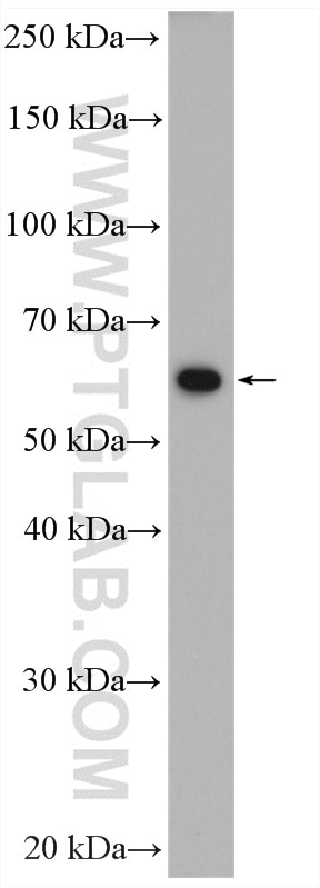Western Blot (WB) analysis of HepG2 cells using PKM Polyclonal antibody (10078-2-AP)
