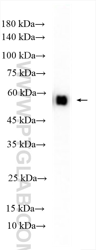 Western Blot (WB) analysis of rat skeletal muscle tissue using PKM Polyclonal antibody (10078-2-AP)