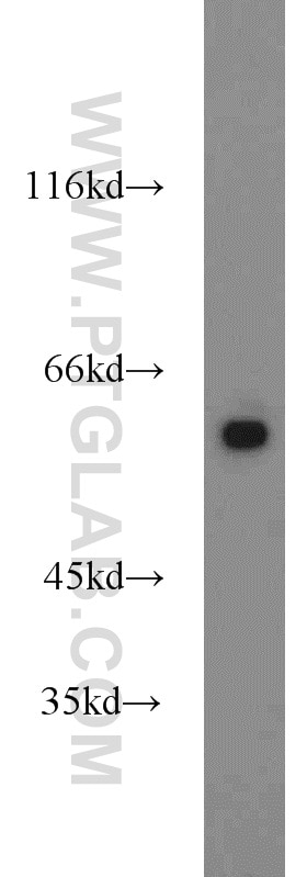Western Blot (WB) analysis of SH-SY5Y cells using PKM Polyclonal antibody (10078-2-AP)