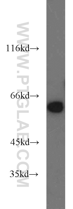 Western Blot (WB) analysis of Jurkat cells using PKM Polyclonal antibody (10078-2-AP)