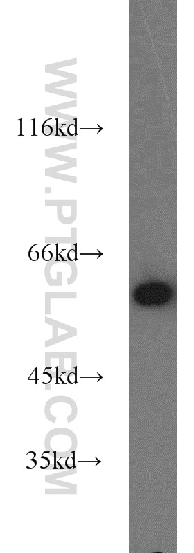 Western Blot (WB) analysis of MCF-7 cells using PKM Polyclonal antibody (10078-2-AP)