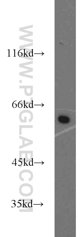 Western Blot (WB) analysis of HepG2 cells using PKM Polyclonal antibody (10078-2-AP)