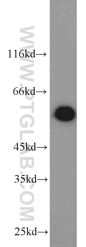 Western Blot (WB) analysis of HeLa cells using PKM Polyclonal antibody (10078-2-AP)