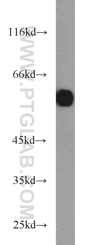 Western Blot (WB) analysis of SKOV-3 cells using PKM Polyclonal antibody (10078-2-AP)