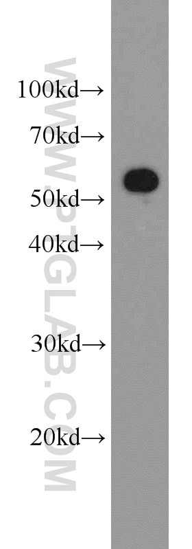 Western Blot (WB) analysis of Raji cells using PKM Polyclonal antibody (10078-2-AP)