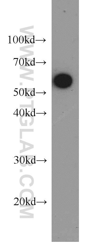 Western Blot (WB) analysis of SH-SY5Y cells using PKM Polyclonal antibody (10078-2-AP)