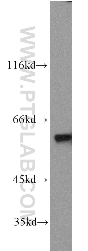Western Blot (WB) analysis of HEK-293 cells using PKM Polyclonal antibody (10078-2-AP)