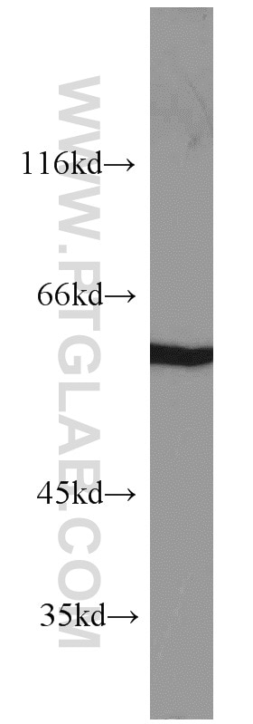 Western Blot (WB) analysis of HeLa cells using PKM Polyclonal antibody (10078-2-AP)