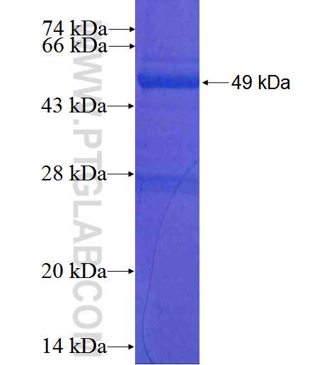 PKM fusion protein Ag0110 SDS-PAGE