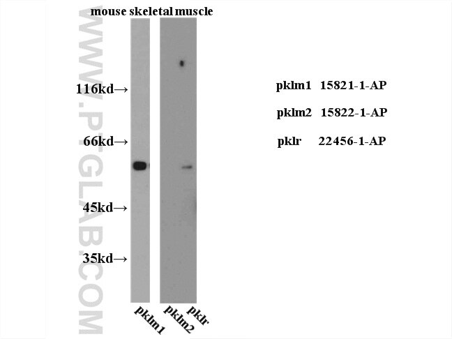 Western Blot (WB) analysis of hela cells using PKM2-specific Polyclonal antibody (15822-1-AP)