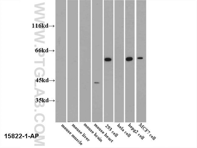 PKM2-specific Polyclonal antibody