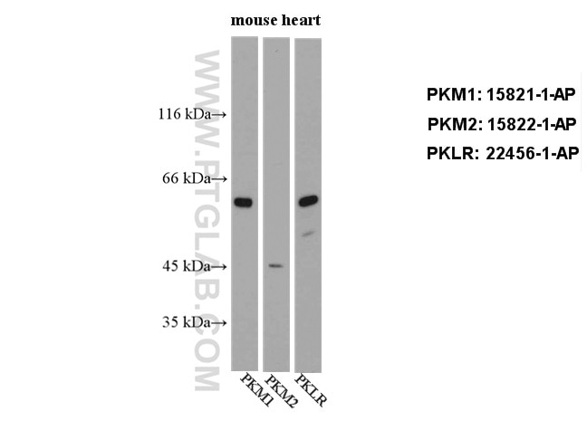 Western Blot (WB) analysis of mouse brain tissue using PKM2-specific Polyclonal antibody (15822-1-AP)