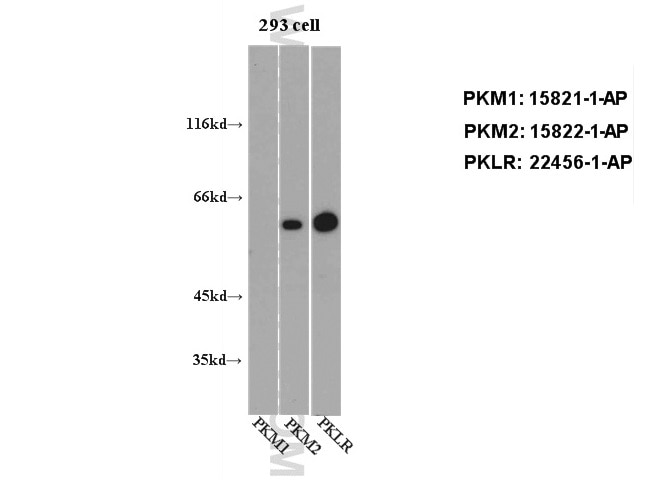 Western Blot (WB) analysis of 293 cell using PKM2-specific Polyclonal antibody (15822-1-AP)